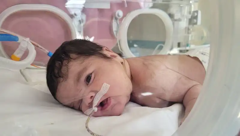 34 Haftalık Eymen Bebek, Dünyada 7. Kez Hayata Tutundu