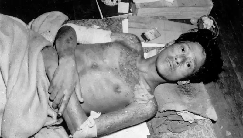 80 Yıl Sonra Nagasaki'den Yükselen Ses: Nükleer Felaket Alarmı