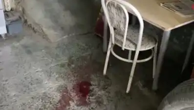 Sandalyeden Düşen Adamın Yaşadığı Kaza: Ağır Yaralanma Anları