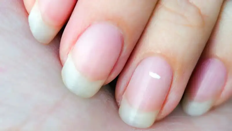 Tırnaklarınızın Durumu Hayatınızı Kestiriyor: Uzmanlar Ne Diyor?